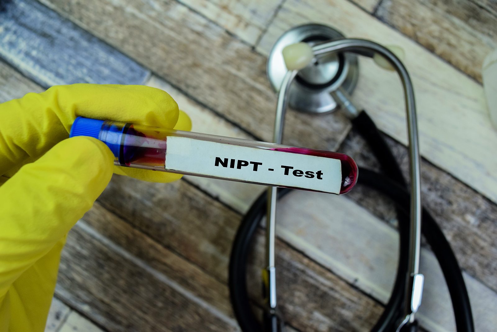 what is prenatal genetic testing